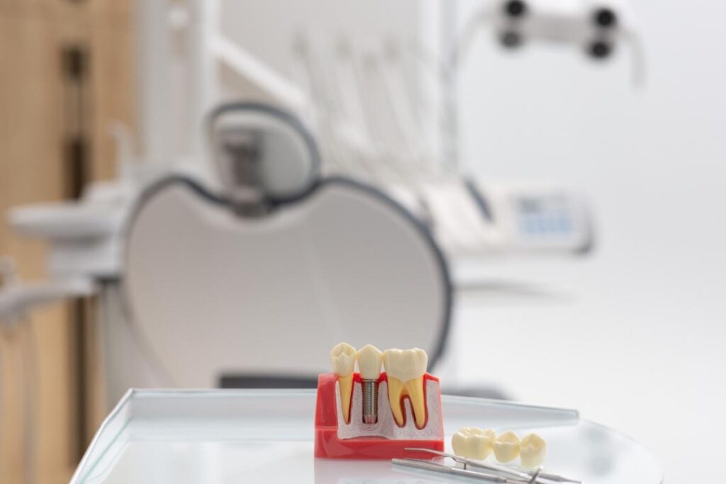 A 3D model of a dental implant at the dentists office