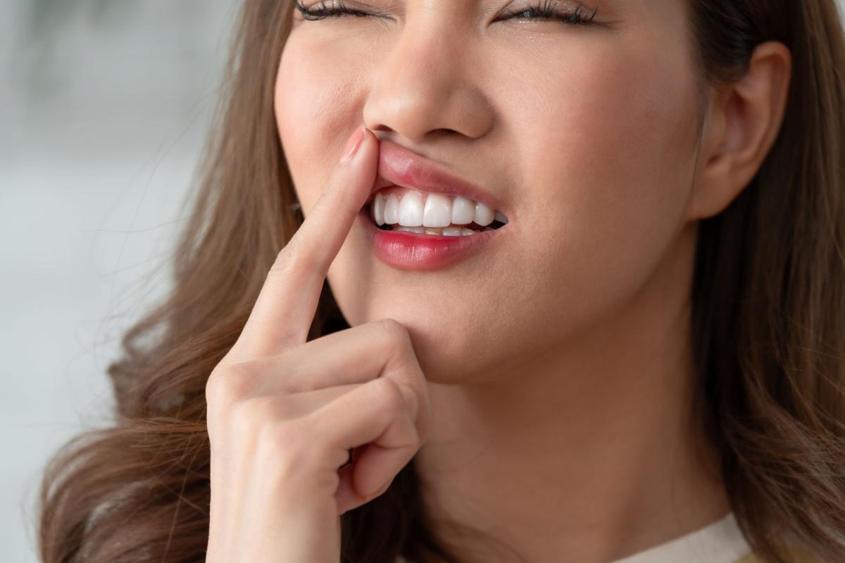 A person pulling their top lip upwards to show their inflamed gums